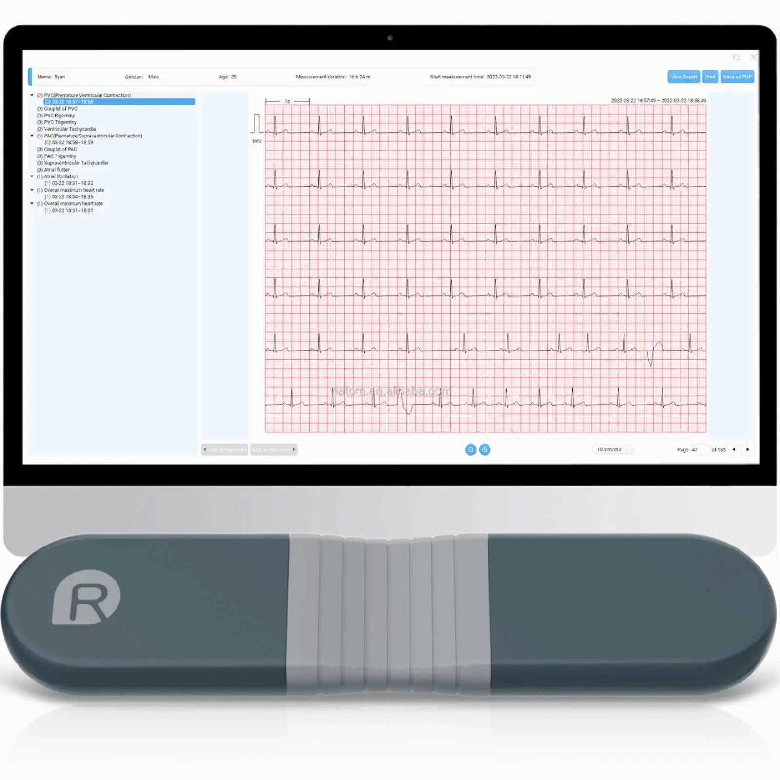 Perekam Dinamis Bluetooth Nirk - Ecg Patch Monitor ulasan dan harga